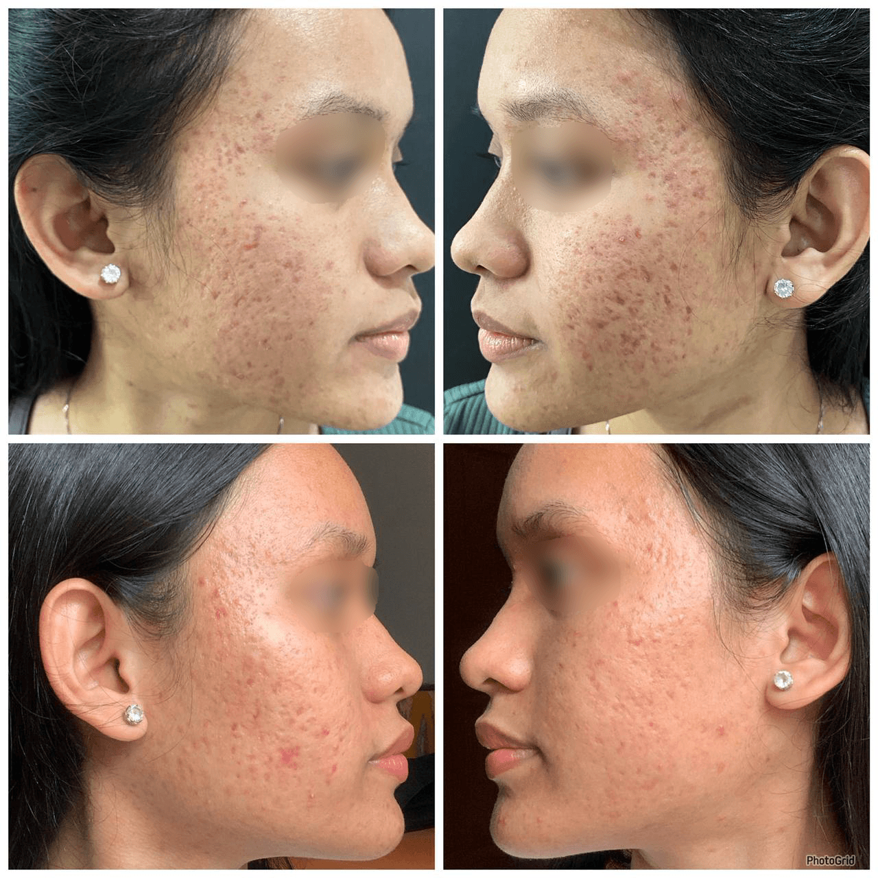 Collagen Booster Salmon